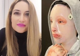 Ιωάννα Παλιοσπύρου – Δημοσίευσε σοκαριστικές φωτογραφίες μετά την επίθεση με το βιτριόλι [σκληρές εικόνες]