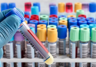 Κοροναϊός – Ο ΕΜΑ ανακοίνωσε την έναρξη αξιολόγησης του χαπιού της MSD κατά του ιού