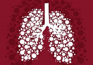 Ο καρκίνος του πνεύμονα αντιμετωπίζεται με πρώιμη διάγνωση