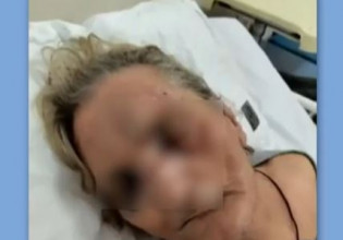 Τζάνειο – Αποκλειστική νοσοκόμα ξυλοκόπησε ηλικιωμένη