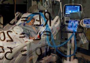 Κοροναϊός – Ασθενείς με μεταβολικό σύνδρομο παρουσιάζουν αυξημένο κίνδυνο θανάτου