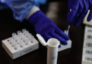ΠΟΕΔΗΝ – Πολύ πιο φθηνά τα PCR από το πλαφόν που ορίστηκε