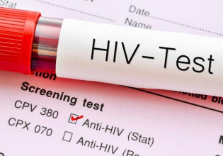 AIDS: Ανακαλύφθηκε στην Ευρώπη μία νέα, πιο παθογόνα και μεταδοτική, παραλλαγή του ιού HIV