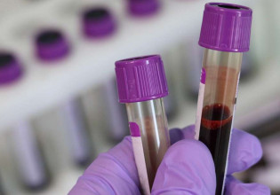 Κοροναϊός: Μεταδίδεται ο ιός μέσω της μετάγγισης αίματος;