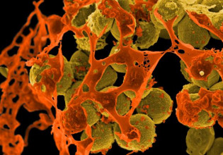 Νέα γενιά αντιβιοτικών υπόσχεται η «συρραφή» γονιδίων από μικρόβια