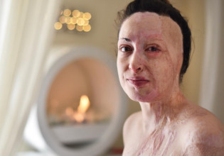 Ολυμπία Κρασαγάκη: «Όταν είδα την Ιωάννα χωρίς μάσκα έπαθα στιγμιαία ένα σοκ»