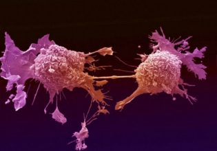 «Ενισχυμένο» μονοκλωνικό αντίσωμα σκοτώνει τα καρκινικά κύτταρα