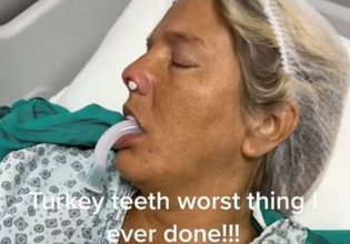 Βρετανία: 35χρονη πήγε να φτιάξει τα δόντια της στην Τουρκία και περιγράφει τη φρίκη που έζησε