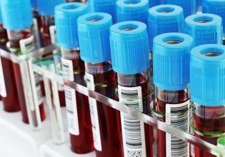 Κοροναϊός: Έρχεται το πρώτο τεστ αίματος που θα προβλέπει ποιος κινδυνεύει με long covid