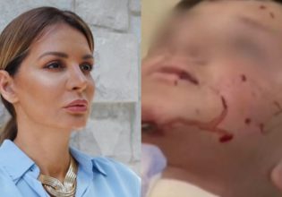 Μαρία Καλάβρια: Ο ανιψιός της δέχθηκε επίθεση από σκύλο – «Έχει σοβαρά τραύματα στον λαιμό και το πρόσωπο»