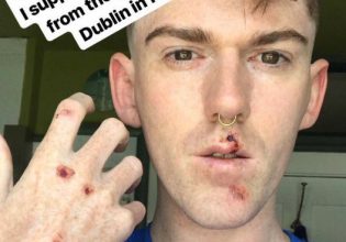 Δουβλίνο: Άγρια επίθεση από ομάδα ανδρών σε τρεις drag queens