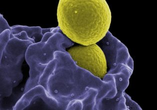 Εξαπλώνεται η μικροβιακή αντοχή και σε απλές λοιμώξεις