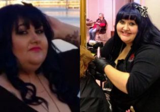 Ήταν υπέρβαρη και την αποκαλούσαν τέρας – Έχασε 104 κιλά και έγινε… μοντέλο