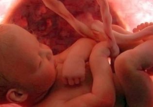 Κοροναϊός: Σοβαρές εγκεφαλικές  βλάβες σε βρέφη που είχαν μολυνθεί κατά την εγκυμοσύνη