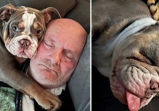 Daily Mail: Ο σκύλος του έφαγε το δάκτυλο του ποδιού του και του έσωσε τη ζωή