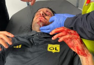 Τραυματίστηκε ο Γκρόσο μετά από επίθεση οπαδών της Μαρσέιγ στο πούλμαν της Λιόν – Αιμόφυρτος ο Ιταλός κόουτς