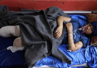 «Πού είναι το πόδι μου»: Η φρίκη των ακρωτηριασμένων παιδιών στη Λωρίδα της Γάζας