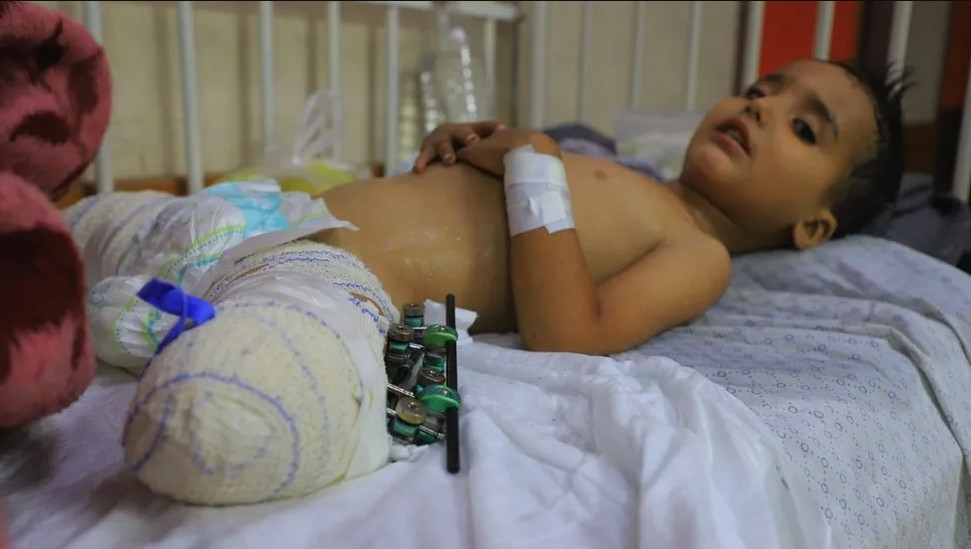 Γάζα: «Έκλαιγε και φώναζε συνεχώς τη νεκρή μαμά της» – Το δράμα των τραυματισμένων ορφανών