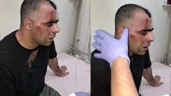 Τουρκία: Ξυλοκόπησαν άγρια δημοσιογράφο και τελικά καταδικάστηκε ο ίδιος για «προσβολή» των δραστών