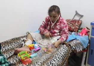 Γάζα: Περισσότερα από 10 παιδιά κάθε μέρα ακρωτηριάζονται στα πόδια – Κάποιες φορές χωρίς νάρκωση