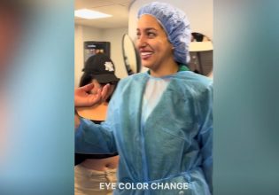Viral: Άλλαξε μόνιμα το χρώμα των ματιών της χωρίς φακούς επαφής