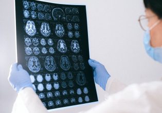 Επιστήμονες ανακάλυψαν τρόπο επιδιόρθωσης της μνήμης στους ασθενείς με Αλτσχάιμερ