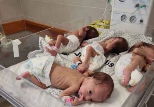 Γάζα: Οι γιατροί δεν βλέπουν πλέον «μωρά φυσιολογικού μεγέθους» – Φρικιαστικές περιγραφές από τον ΟΗΕ