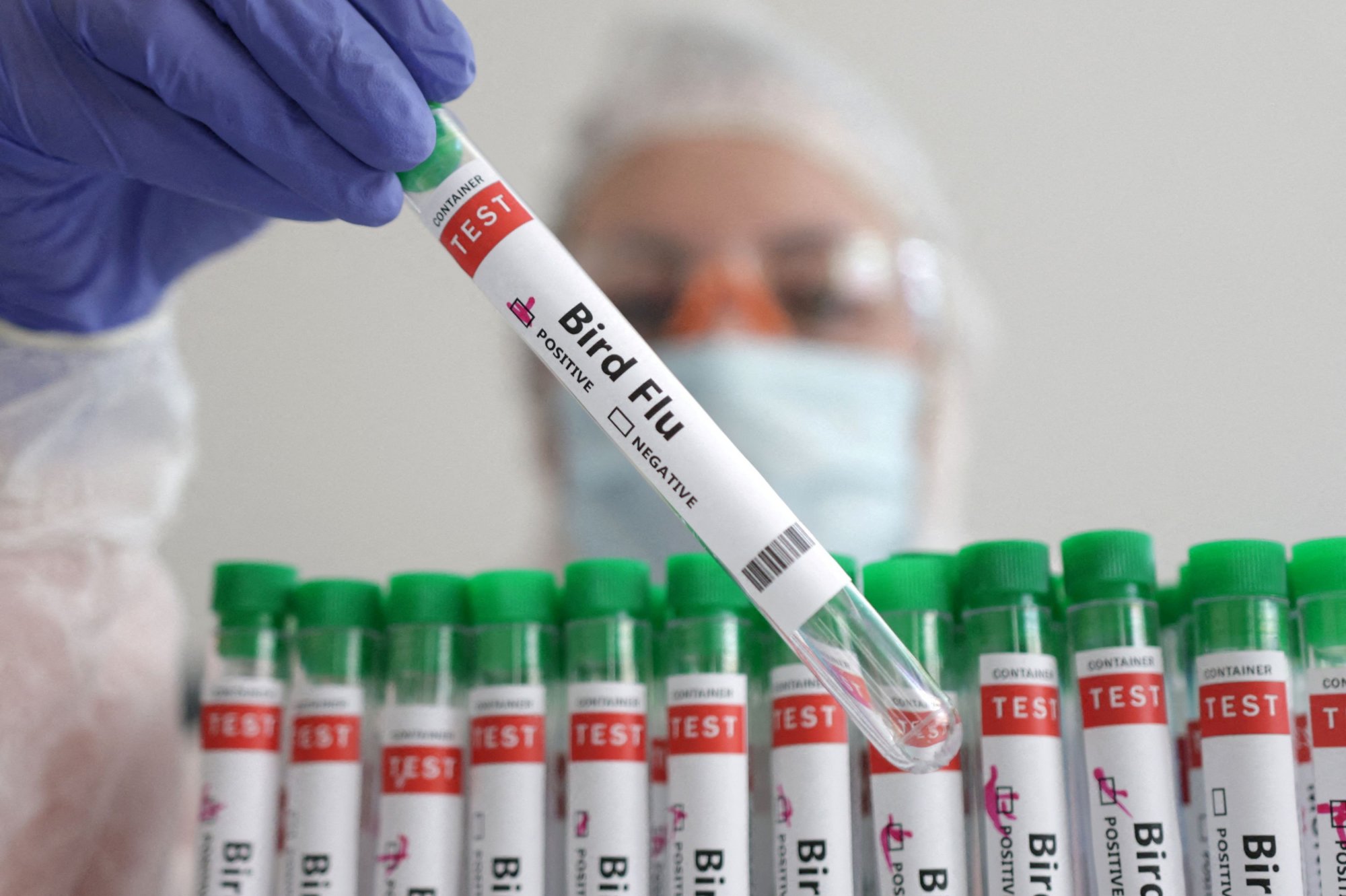 ΠΟΥ: Επιβεβαίωσε το πρώτο θανατηφόρο ανθρώπινο κρούσμα γρίπης των πτηνών στον κόσμο