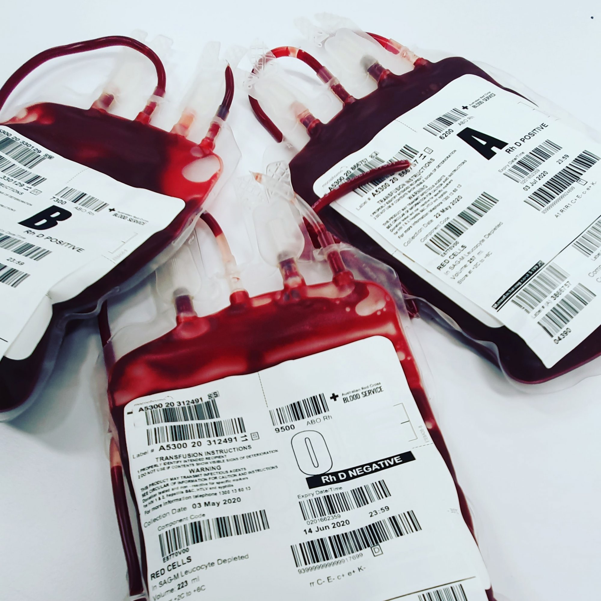 Από εθελοντές αιμοδότες σχεδόν το 70% του αίματος που χρειαζόμαστε