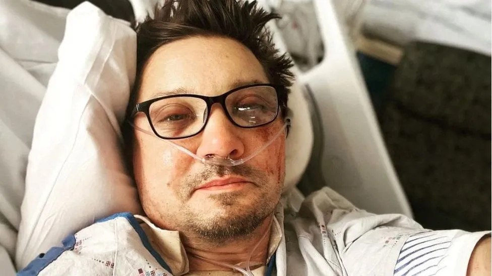 Τζέρεμι Ρένερ: Φωτογραφίζεται και δείχνει τις ουλές στο σώμα του μετά το σοβαρό ατύχημα