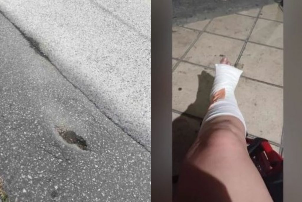 Θεσσαλονίκη: Σοβαρός τραυματισμός γυναίκας λόγω υποχώρησης οδοστρώματος – «Έχω πολλαπλά κατάγματα»