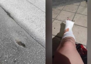 Θεσσαλονίκη: Σοβαρός τραυματισμός γυναίκας λόγω υποχώρησης οδοστρώματος – «Έχω πολλαπλά κατάγματα»