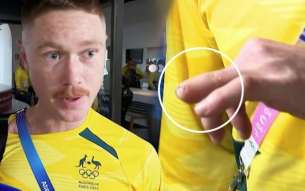 Ολυμπιακοί Αγώνες: Αυστραλός παίκτης χόκεϊ επί χόρτου ακρωτηρίασε το δάκτυλο του για να αγωνιστεί
