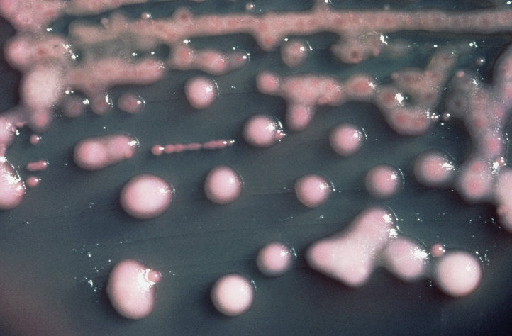 Klebsiella: Προειδοποίηση ΠΟΥ για «υπερλοιμογόνο» βακτήριο με ανθεκτικότητα σε όλα τα αντιβιοτικά