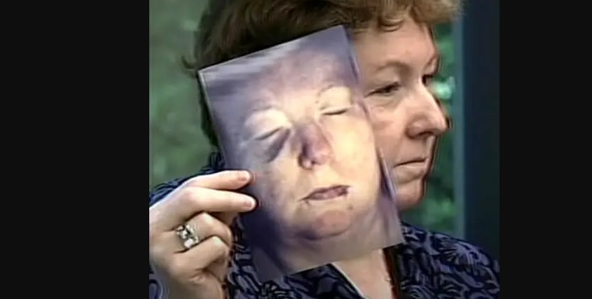 Σούζαν Κουνχάουζεν: Ο σύζυγός της έβαλε εκτελεστή να τη σκοτώσει – Εκείνη επιβίωσε, ο εκτελεστής όχι
