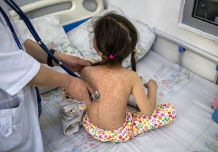 Ιλαρά: Διπλασιάστηκαν σε ένα χρόνο τα κρούσματα στην Ευρώπη – Η κατάσταση στην Ελλάδα