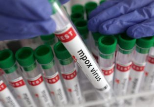 Ιός mpox: Συναγερμός στον ΕΟΔΥ: Καταγράφηκαν 18 επιβεβαιωμένα κρούσματα